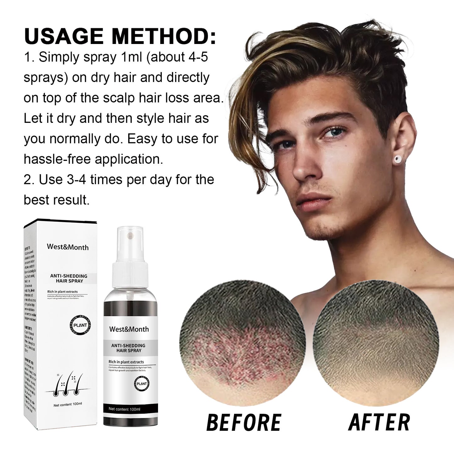 Anti-hair Loss Spray Improves Hairline Dense Hair Fixation - Online Shop AU.com