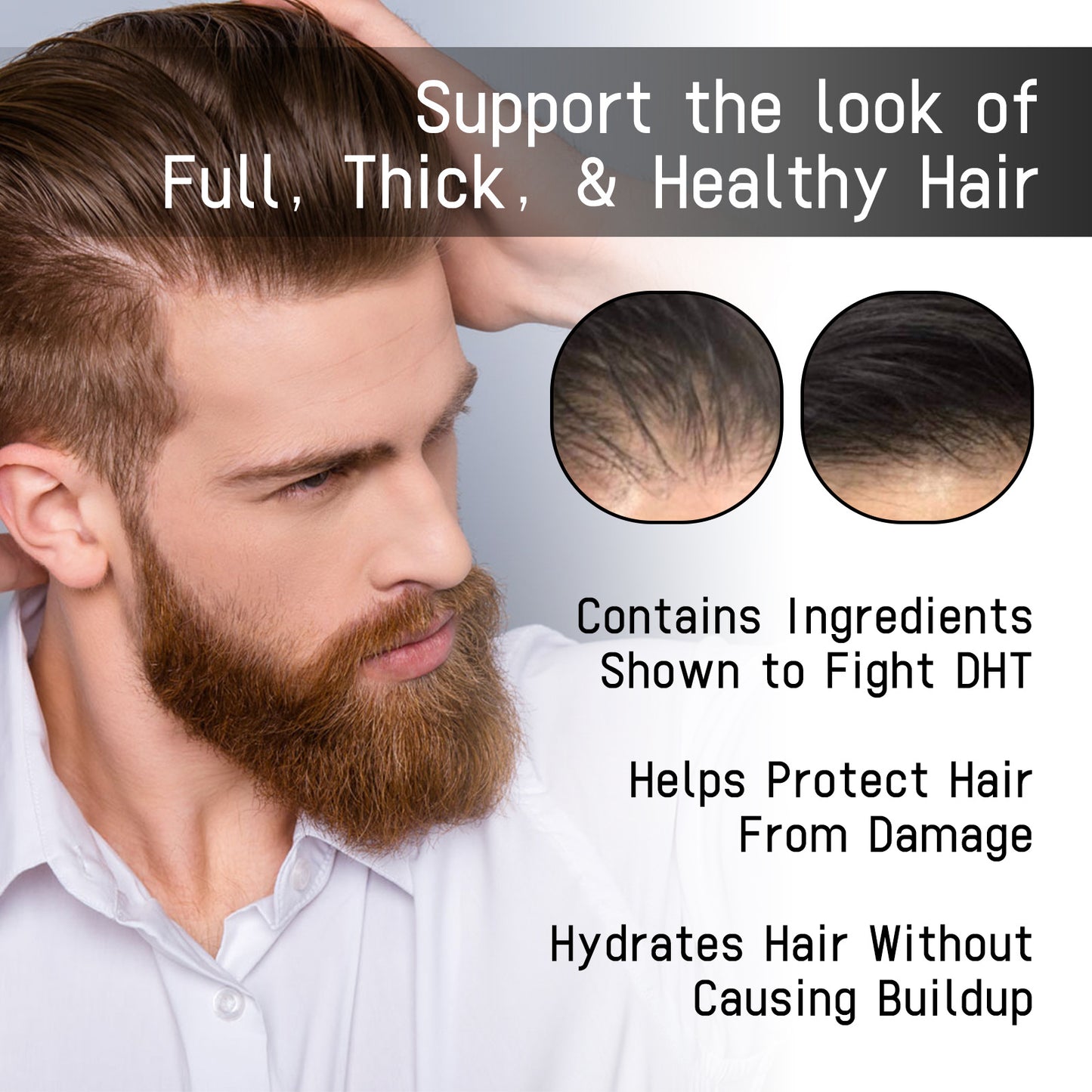 Anti-hair Loss Spray Improves Hairline Dense Hair Fixation